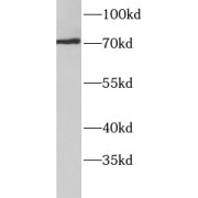 WB analysis of HepG2 cells, using ACSS3 antibody (1/300 dilution).