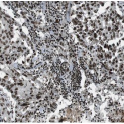 Actin Like Protein 6A (ACTL6A) Antibody
