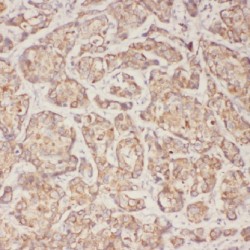 Alpha Actinin 4 (ACTN4) Antibody