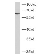 WB analysis of HepG2 cells, using ADAD2 antibody (1/500 dilution).