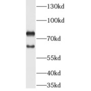 WB analysis of A549 cells, using ADAM28 antibody (1/800 dilution).