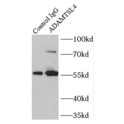 ADAMTS-Like Protein 4 (ADAMTSL4) Antibody