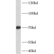 WB analysis of mouse brain tissue, using ADAMTSL4 antibody (1/500 dilution).