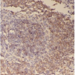 ArfGAP With Dual PH Domains 2 (ADAP2) Antibody