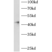 WB analysis of human placenta tissue, using ADAP2 antibody (1/200 dilution).