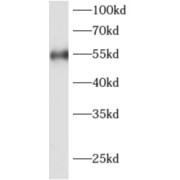 WB analysis of human heart tissue, using ADAT1 antibody (1/1000 dilution).