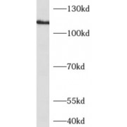 WB analysis of Y79 cells, using ADCY1 antibody (1/500 dilution).