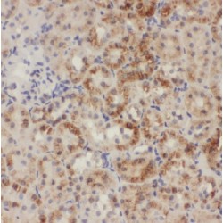 Adenylate Cyclase 3 (ADCY3) Antibody