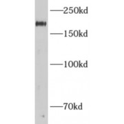 WB analysis of mouse skeletal muscle tissue, using ADCY3 antibody (1/300 dilution).