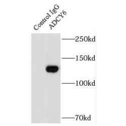 Adenylate Cyclase 6 (ADCY6) Antibody