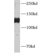 WB analysis of human brain tissue, using ADCY6 antibody (1/200 dilution).