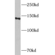 WB analysis of Neuro-2a cells, using ADCY8 antibody (1/1000 dilution).