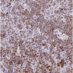 Adenylosuccinate Lyase (ADSL) Antibody