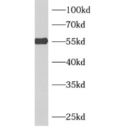 WB analysis of HeLa cells, using ADSL antibody (1/400 dilution).