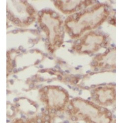 Alcohol Dehydrogenase 4 (Class II), Pi Polypeptide (ADH4) Antibody