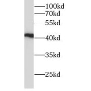 WB analysis of mouse liver tissue, using ADH4 antibody (1/1000 dilution).