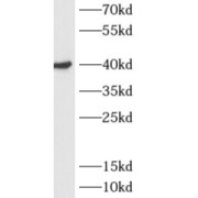 WB analysis of human liver tissue, using ADH6 antibody (1/500 dilution).