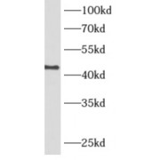 WB analysis of HeLa cells, using ADH7 antibody (1/1000 dilution).