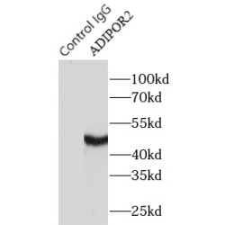 Adiponectin Receptor 2 (ADIPOR2) Antibody