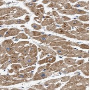 IHC-P analysis of human heart tissue, using ADM2 Antibody (1/50 dilution).