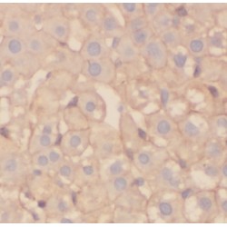 ADP Dependent Glucokinase (ADPGK) Antibody