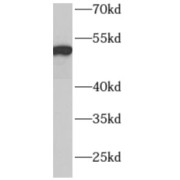 WB analysis of human liver tissue, using ADPGK antibody (1/500 dilution).