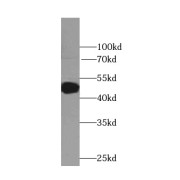 WB analysis of mouse brain tissue, using ADRA2B-Specific antibody (1/100 dilution).