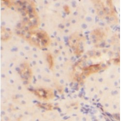 Adrenomedullin (ADM) Antibody