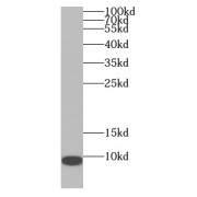 WB analysis of human kidney tissue, using ADM antibody (1/1000 dilution).