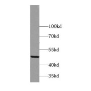 WB analysis of human adipose tissue, using ADRP antibody (1/1000 dilution).