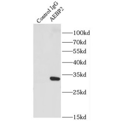 Zinc Finger Protein AEBP2 (AEBP2) Antibody