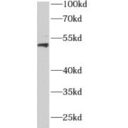 WB analysis of human testis tissue, using AEBP2 antibody (1/100 dilution).