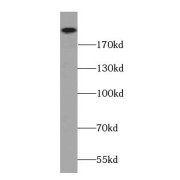 WB analysis of mouse kidney tissue, using MLLT4 antibody (1/500 dilution).