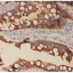 Actin Filament Associated Protein 1 Like 1 (AFAP1L1) Antibody