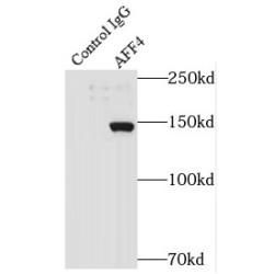 AF4/FMR2 Family Member 4 (AFF4) Antibody