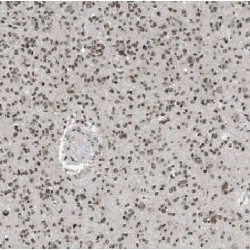 Arf-GAP With GTPase, ANK Repeat And PH Domain Containing Protein 2 (AGAP2) Antibody