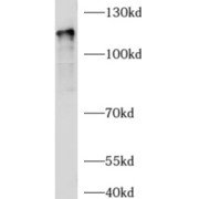 WB analysis of human brain tissue, using AGAP2 antibody (1/500 dilution).