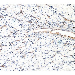 Advanced Glycosylation End Product Specific Receptor (AGER) Antibody