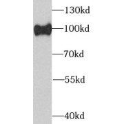 WB analysis of Jurkat cells, using EIF2C2 antibody (1/1000 dilution).