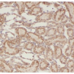 Glycerol-3-Phosphate Acyltransferase 3 (AGPAT9) Antibody