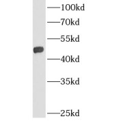 WB analysis of rat kidney tissue, using AGPAT9 antibody (1/1500 dilution).