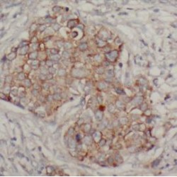 Anterior Gradient Protein 2 (AGR2) Antibody