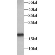 WB analysis of mouse stomach tissue, using AGR2 antibody (1/1000 dilution).