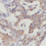 IHC-P analysis of human pancreas tissue, using AGXT2L2 antibody (1/50 dilution).