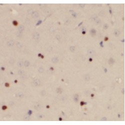 Aryl Hydrocarbon Receptor (AHR) Antibody