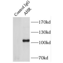 Aryl Hydrocarbon Receptor (AHR) Antibody