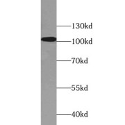 WB analysis of MCF7 cells, using AHR antibody (1/1000 dilution).