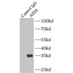 Axin Interactor, Dorsalization Associated (AIDA) Antibody