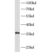 WB analysis of HEK-293 cells, using AIDA antibody (1/600 dilution).