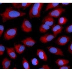 Apoptosis Inducing Factor (AIF) Antibody